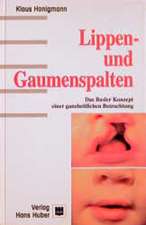 Lippen- und Gaumenspalten