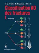 Classification Ao Des Fractures