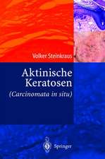 Aktinische Keratosen (Carcinomata in situ)