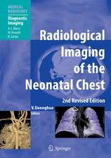 Radiological Imaging of the Neonatal Chest