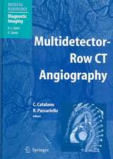 Multidetector-Row CT Angiography