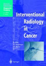 Interventional Radiology in Cancer