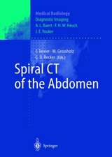 Spiral CT of the Abdomen