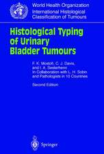 Histological Typing of Urinary Bladder Tumours