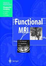 Functional MRI