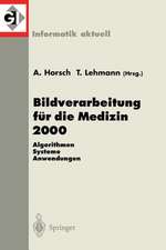 Bildverarbeitung für die Medizin 2000: Algorithmen - Systeme - Anwendungen