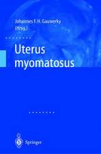 Uterus Myomatosus