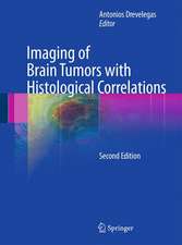 Imaging of Brain Tumors with Histological Correlations