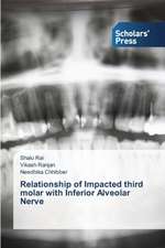 Relationship of Impacted Third Molar with Inferior Alveolar Nerve