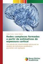 Redes Complexas Formadas a Partir de Estimativas de Espessura Cortical: Fotoluminescencia E Crescimento de Nanoparticulas