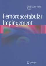 Femoroacetabular Impingement