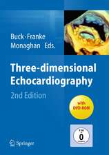 Three-dimensional Echocardiography