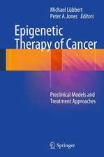 Epigenetic Therapy of Cancer: Preclinical Models and Treatment Approaches