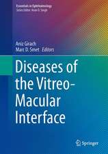 Diseases of the Vitreo-Macular Interface