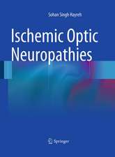 Ischemic Optic Neuropathies