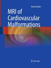 MRI of Cardiovascular Malformations