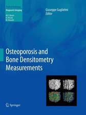 Osteoporosis and Bone Densitometry Measurements