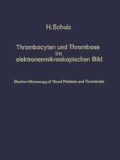 Thrombocyten und Thrombose im elektronenmikroskopischen Bild / Electron Microscopy of Blood Platelets and Thrombosis