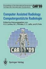 CAR’89 Computer Assisted Radiology / Computergestützte Radiologie: Proceedings of the 3rd International Symposium / Vorträge des 3. Internationalen Symposiums