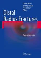 Distal Radius Fractures: Current Concepts