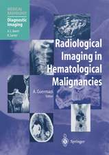 Radiological Imaging in Hematological Malignancies