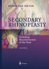 Secondary Rhinoplasty: Including Reconstruction of the Nose