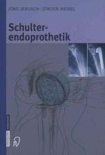 Schulterendoprothetik: Indikation, Implantate, OP-Technik, Nachbehandlung, Begutachtung