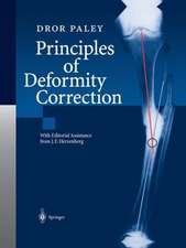 Principles of Deformity Correction