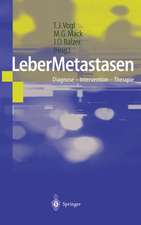 LeberMetastasen: Diagnose — Intervention — Therapie