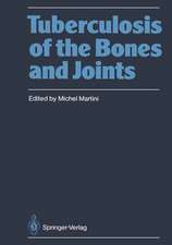 Tuberculosis of the Bones and Joints