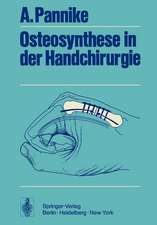 Osteosynthese in der Handchirurgie