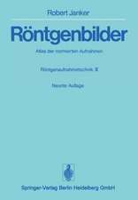 Röntgenbilder: Atlas der normierten Aufnahmen. Röntgenaufnahmetechnik · Teil II