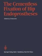 The Cementless Fixation of Hip Endoprostheses