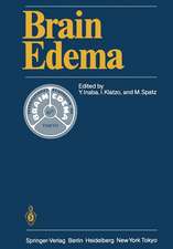 Brain Edema: Proceedings of the Sixth International Symposium, November 7–10, 1984 in Tokyo