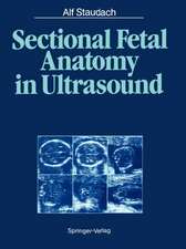 Sectional Fetal Anatomy in Ultrasound