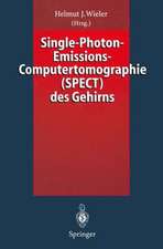 Single-Photon-Emissions-Computertomographie (SPECT) des Gehirns