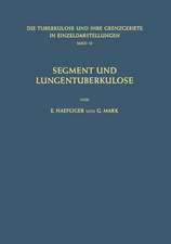 Segment und Lungentuberkulose