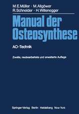 Manual der Osteosynthese: AO-Technik