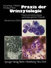 Praxis der Urinzytologie: Phasenkontrastmikroskopie und Analyse gefärbter Präparate