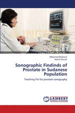 Sonographic Findinds of Prostate in Sudanese Population