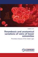 Thrombosis and anatomical variations of veins of lower extremities