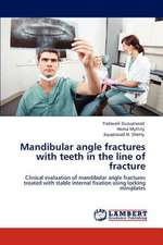 Mandibular angle fractures with teeth in the line of fracture