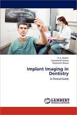 Implant Imaging in Dentistry