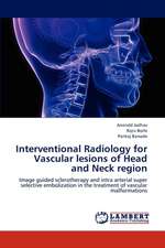 Interventional Radiology for Vascular lesions of Head and Neck region