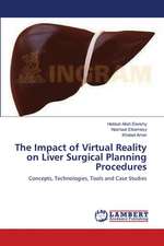 The Impact of Virtual Reality on Liver Surgical Planning Procedures