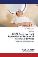 MSCT Detection and Evaluation of Lesions of Paranasal Sinuses