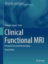 Clinical Functional MRI: Presurgical Functional Neuroimaging