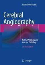 Cerebral Angiography: Normal Anatomy and Vascular Pathology