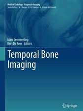 Temporal Bone Imaging