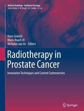 Radiotherapy in Prostate Cancer: Innovative Techniques and Current Controversies